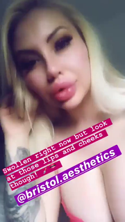 Video by AirheadBimboTrainer with the username @AirheadBimboTrainer,  November 1, 2019 at 12:53 AM. The post is about the topic DSLs and the text says 'Want to wreck that freshly swollen cuntmouth.

https://gfycat.com/glossyfrenchblacknorwegianelkhound'