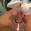 Foreskin pumped -Foreskin restoration informati…