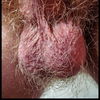 Hairy ballsack -Just hairy balls. Big ones and…