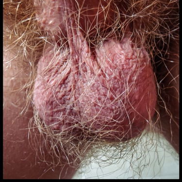 Hairy ballsack -Just hairy balls. Big ones and…