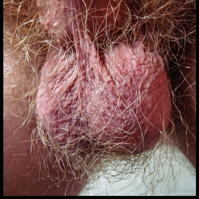 Posted in topic Hairy ballsack