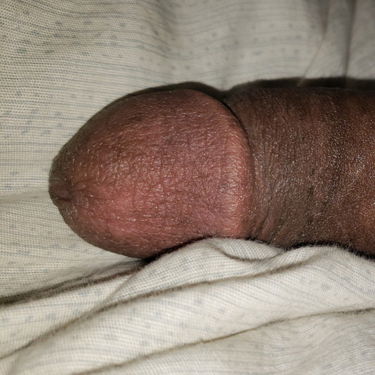 My dick 69 