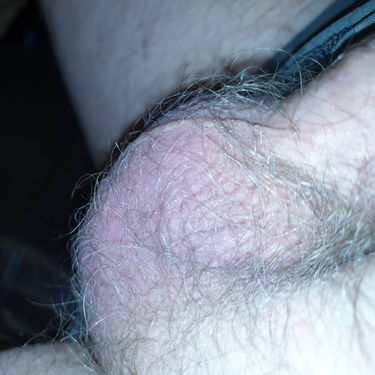 My small genitalia -Uploaded real pics taken of my…