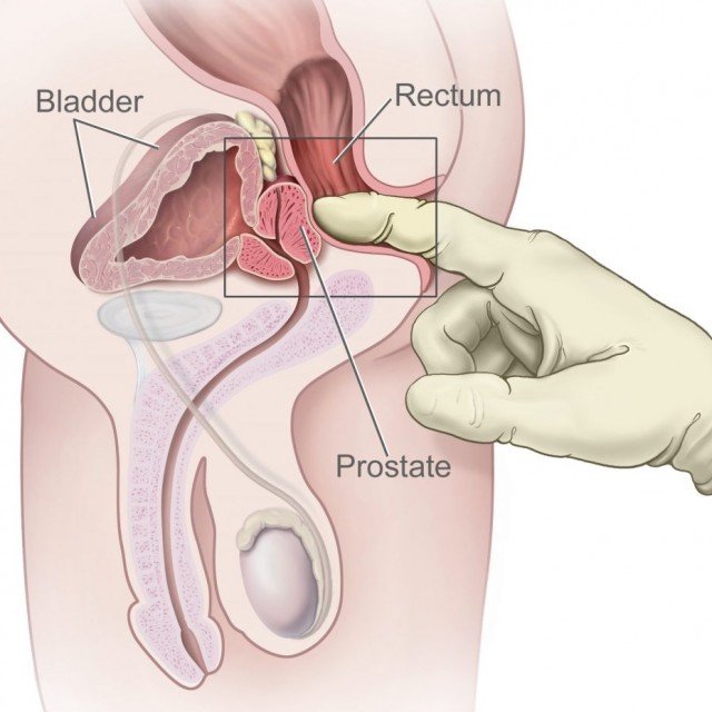 Prostate play