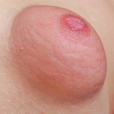 Puffy Tits -All about the puffies. The puf…