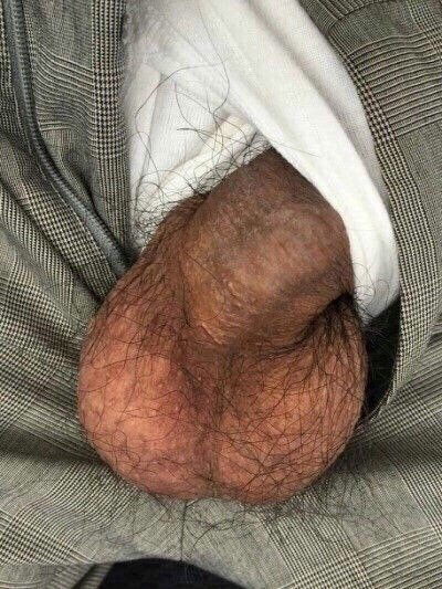 Photo by Smitty with the username @Resol702, posted on July 11, 2020. The post is about the topic Hairy ballsack