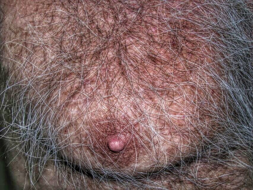 Watch the Photo by Smitty with the username @Resol702, posted on May 1, 2020. The post is about the topic Hairy Man Nips..