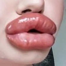 Big-Lips