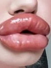 Big-Lips