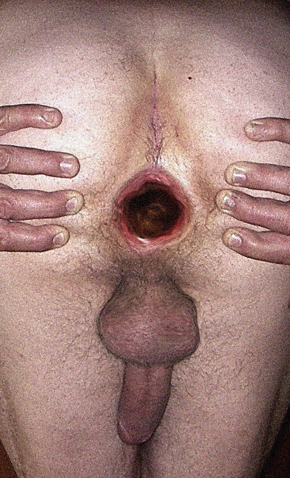 Photo by peo1 with the username @peo1,  May 10, 2022 at 4:13 PM. The post is about the topic Gay and the text says 'my hole very stretched out ready for a BIG cock'