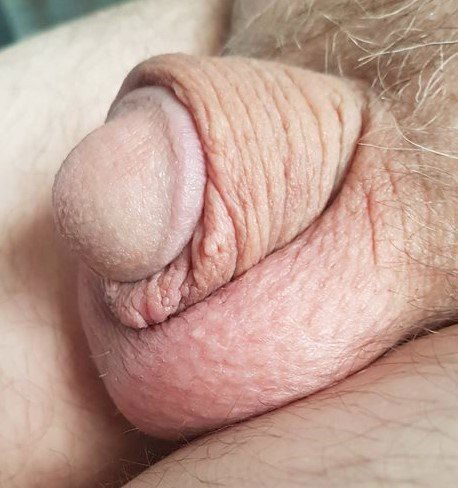 Photo by small-cock3.5inch with the username @small-cock3.5inch,  June 7, 2024 at 7:21 AM. The post is about the topic Circumcised cock and the text says 'Circumcised small cock'