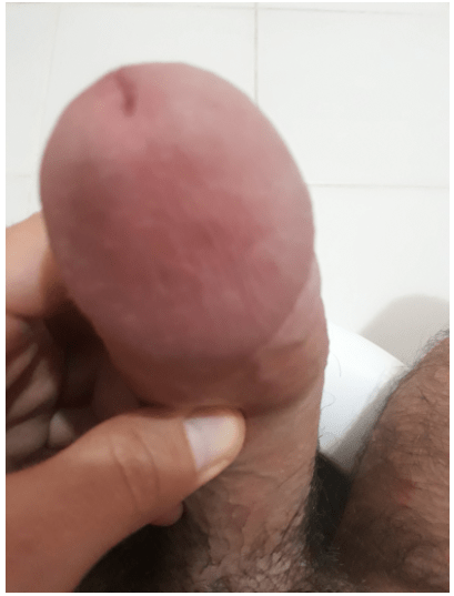 Photo by yilmazcan6078 with the username @yilmazcan6078,  December 2, 2021 at 4:32 AM. The post is about the topic Rate my pussy or dick