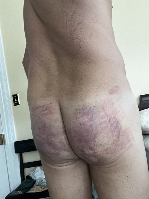 Photo by Danny-tr with the username @Danny-tr, who is a verified user,  October 21, 2024 at 5:10 PM. The post is about the topic Sissy Boy and the text says 'looks loke a bit bruised by goddess'