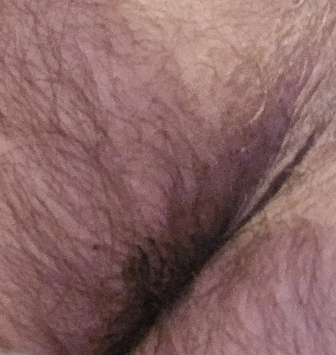 Photo by Gaybird1957 with the username @Gaybird1957, who is a verified user,  May 22, 2024 at 7:50 AM. The post is about the topic Gay hairy asshole