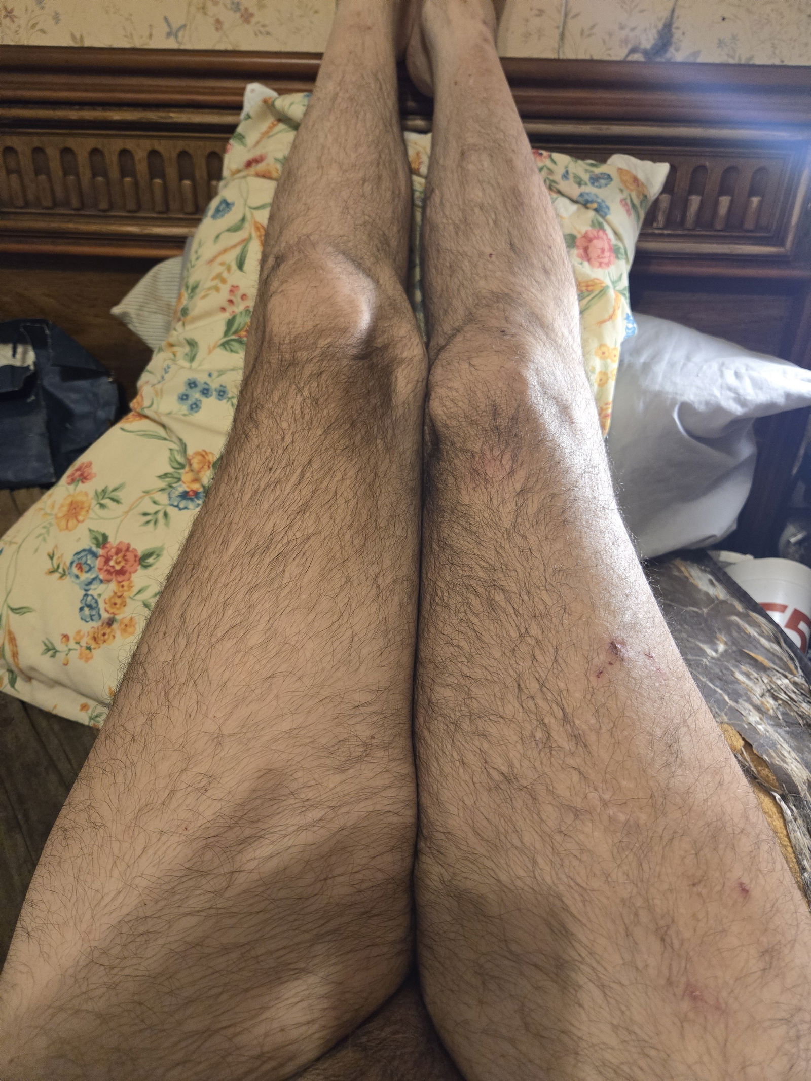 Album by Gaybird1957 with the username @Gaybird1957, who is a verified user,  June 30, 2024 at 3:35 PM. The post is about the topic Gay hairy legs