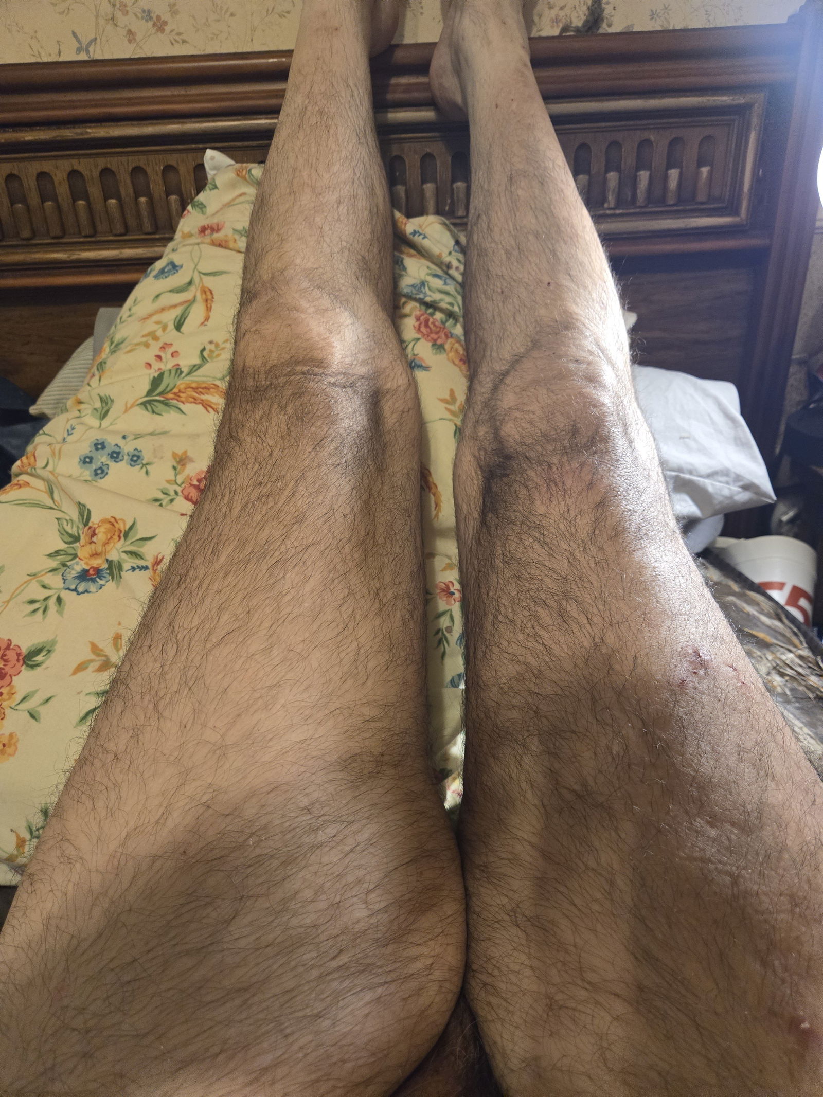 Album by Gaybird1957 with the username @Gaybird1957, who is a verified user,  June 30, 2024 at 3:35 PM. The post is about the topic Gay hairy legs