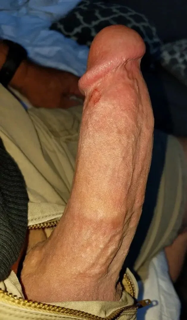 Photo by Eight inched Ed with the username @eightinched, who is a verified user,  December 23, 2023 at 8:18 PM and the text says 'my cock fully erect complete with teeth mark bruises!!

#eightinched #hugecock #thickdick #monstercock #fatdick #hung #9inchcock #beercan #girth #longdick #bigdick #bwc #me #massivecock #erection #thickness #pussystretcher #fatcock'