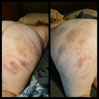 Album by SadisticMrD with the username @SadisticMrD, who is a verified user,  December 15, 2018 at 9:32 PM. The post is about the topic BDSM and the text says 'My redhead caned and bruised'