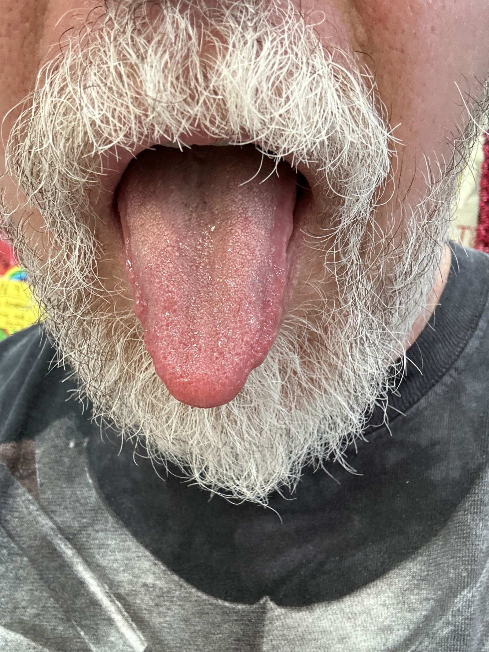 Photo by DirtyDaddyFunStuff with the username @DirtyDaddyPorn, who is a verified user,  June 20, 2024 at 1:24 AM and the text says 'Your #hairy #bear blog master'