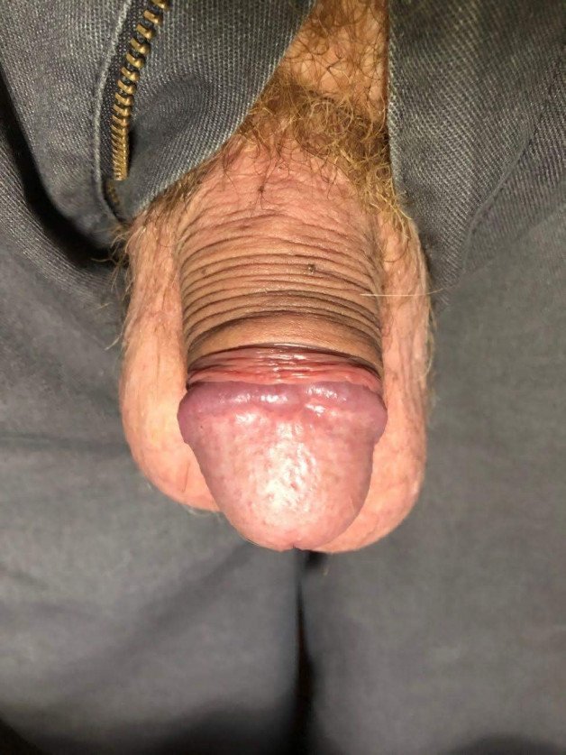 Photo by Xtraskin with the username @Xtraskin, who is a verified user,  August 2, 2024 at 11:08 AM. The post is about the topic Rate my pussy or dick and the text says 'Soft version'