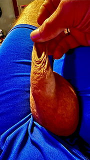 Photo by Xtraskin with the username @Xtraskin, who is a verified user,  August 22, 2024 at 5:37 PM. The post is about the topic foreskin stretching & fingering