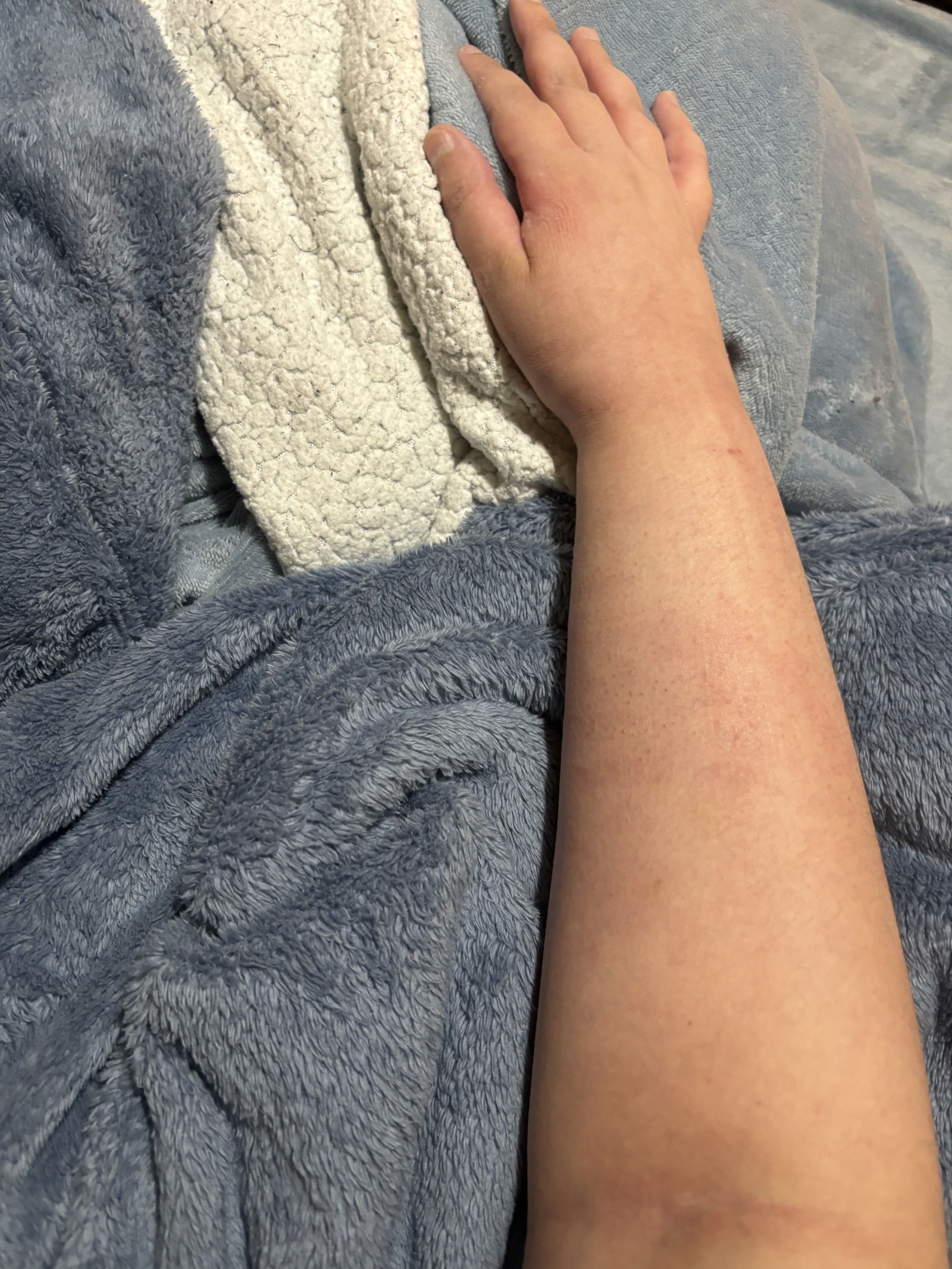 Album by lilimariexx with the username @lilimariexx, who is a star user,  July 13, 2024 at 7:02 PM and the text says 'UPDATE : I am healed enough that my arm is free of a cast As you can see, I just have to wear my brace when I sleep and stuff it&#039;s very nice to not have to wear a cast anymore. I am very happy. Best news possible.🥰'