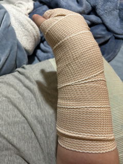 Photo by lilimariexx with the username @lilimariexx, who is a star user,  June 6, 2024 at 10:14 PM and the text says 'got bad news today I need surgery The bones are pulled apart in my arm They will be putting a plate and screws in my arm very soon So more healing time At this point, I don't know when I'll be back This New splint barely has any padding So I'm even in..'