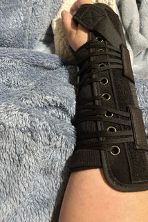 Album by lilimariexx with the username @lilimariexx, who is a star user,  July 13, 2024 at 7:02 PM and the text says 'UPDATE : I am healed enough that my arm is free of a cast As you can see, I just have to wear my brace when I sleep and stuff it&#039;s very nice to not have to wear a cast anymore. I am very happy. Best news possible.🥰'