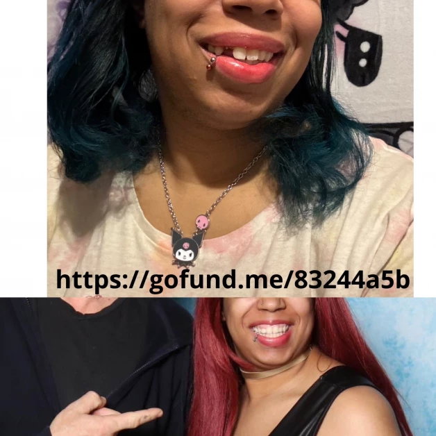 Photo by @36ddds with the username @averyhornyvirgo, who is a star user,  April 6, 2024 at 7:28 AM and the text says 'Lost a crown today. Need funding for implant. Help would be appreciated. Here’s my GoFundMe link. http://gofund.me/83244a5b 

#teeth #tooth #GoFundMe #gofundmedonations #smile #Dentist #smiling #fundraiser #fundraising #crown #rootcanal'