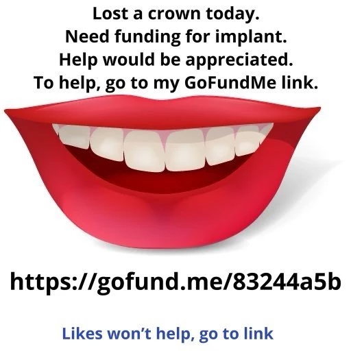 Photo by @36ddds with the username @averyhornyvirgo, who is a star user,  April 6, 2024 at 7:29 AM and the text says 'Lost a crown today. Need funding for implant. Help would be appreciated. Here’s my GoFundMe link. http://gofund.me/83244a5b 

#teeth #tooth #GoFundMe #gofundmedonations #smile #Dentist #smiling #fundraiser #fundraising #crown #rootcanal'