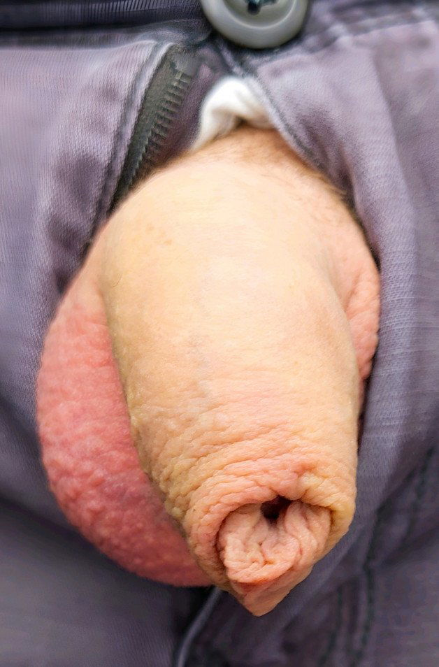 Photo by DickFrotter69 with the username @DickFrotter69, who is a verified user,  July 12, 2024 at 11:21 PM. The post is about the topic Cocks with foreskin