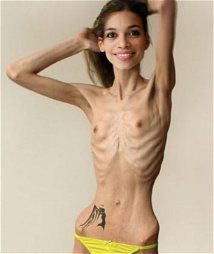 Photo by modificator with the username @modificator,  November 8, 2018 at 1:19 PM and the text says 'Bones are so sexy! #starvation  #bones  #anorexic  #proana'