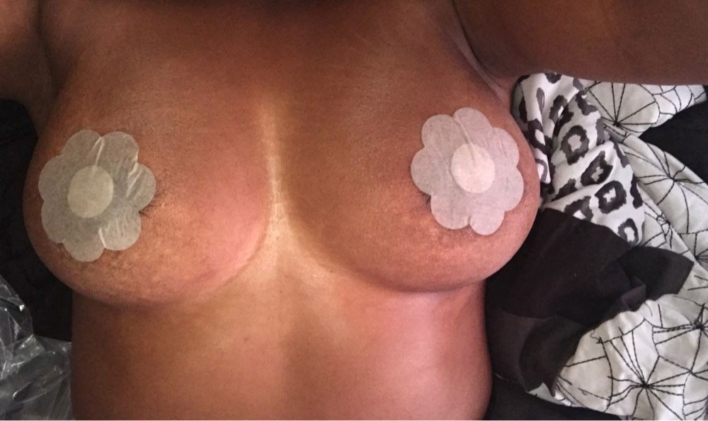 Photo by alierotic2 with the username @alierotic2,  August 14, 2017 at 6:00 PM and the text says 'Bluelans 5 Pairs Women&rsquo;s Invisible Breast Lift Tape Stick on Bra Sticker Nipple Covers Dress
Buyer: P****a S. (detail)
Via: http://www.aliexpress.com/item//32755137991.html #bluelans  #5  #pairs  #women's  #invisible  #breast  #lift  #tape  #stick..'