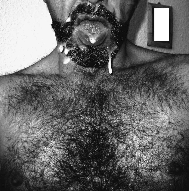 Photo by Nickplus33 with the username @Nickplus33, who is a verified user,  April 2, 2024 at 3:33 AM and the text says '#blackandwhite #daddy #hairy #cumfacial #beard #cummybeard #cumeater #tongue'