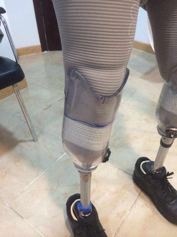 Photo by ampstef with the username @ampstef,  May 10, 2015 at 1:00 AM and the text says 'prostheticleg:

some rather cute guys wearing their pros legs and without too…'