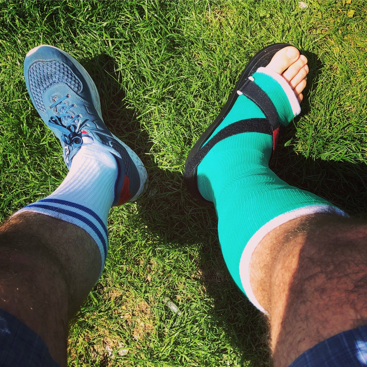 Photo by ampstef with the username @ampstef,  June 29, 2018 at 8:50 PM and the text says 'castmande:

Fresh green #brokenleg #brokenfoot #brokenankle #gayfetish #gipsbein #gips #gesso #yeso #legcast'