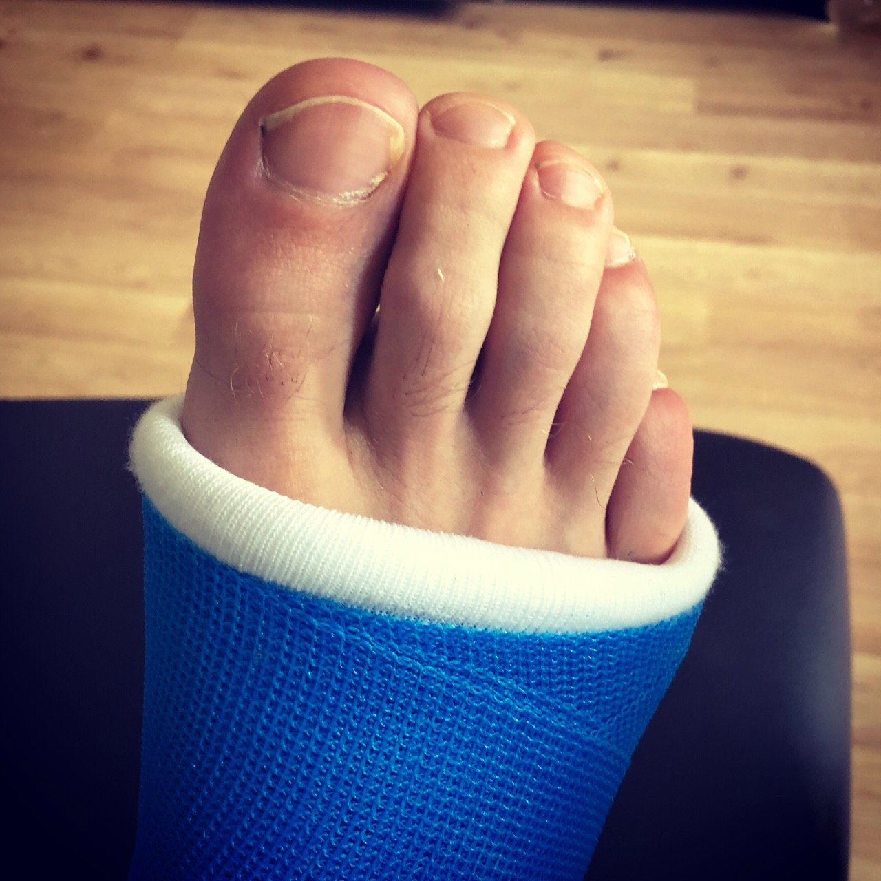 Photo by ampstef with the username @ampstef,  June 29, 2018 at 8:47 PM and the text says 'castmande:

Close up of my #toes in my #legcast #brokenleg #brokenfoot'