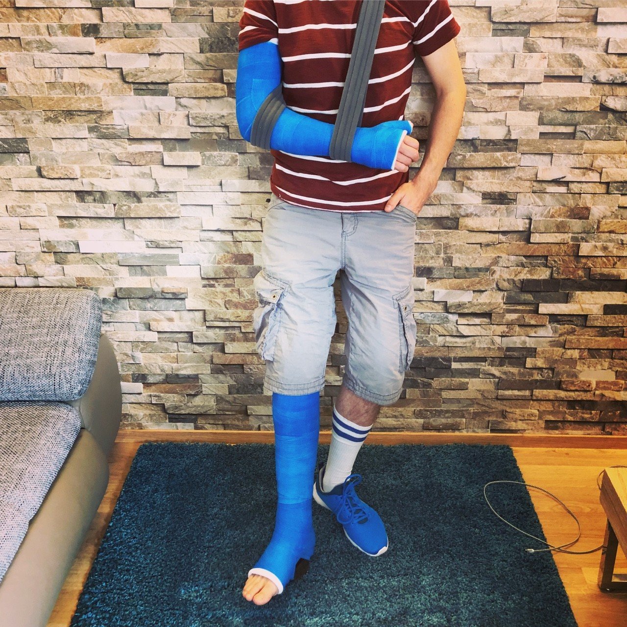 Photo by ampstef with the username @ampstef,  June 29, 2018 at 8:47 PM and the text says 'castmande:

Ready for a walk #brokenleg #brokenfoot #brokenarm #brokenhand #chastity #gayfetish #gips #gipsarm #gipsbein #gesso #yeso #platre'