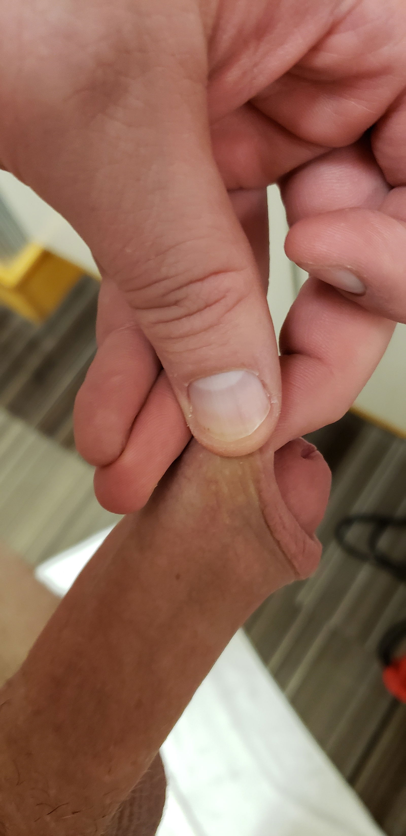 Album by supersword99 with the username @supersword99, who is a verified user,  February 23, 2019 at 12:23 AM. The post is about the topic Restore foreskin and the text says 'More after gym. I'm starting to have some coverage if I pull on it'