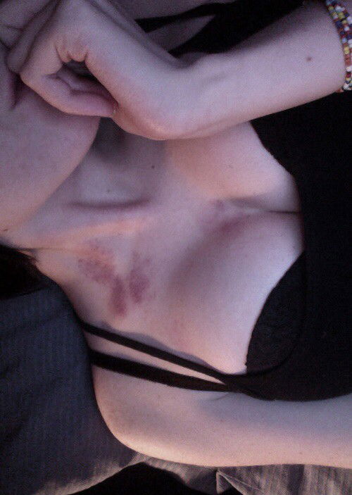 Photo by forbiddnfruit with the username @forbiddnfruit,  January 25, 2017 at 10:27 PM and the text says '#nsfw  #image  #female  #boobs  #cleavage  #hickies'