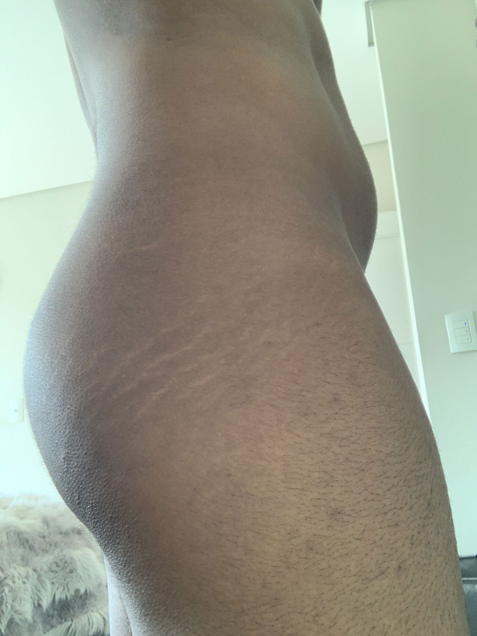 Watch the Photo by Josh with the username @011j, posted on June 8, 2023. The post is about the topic Stretch Marks. and the text says 'I love my stretch marks💙

#stretchmarks #straightmen #bodypositive'