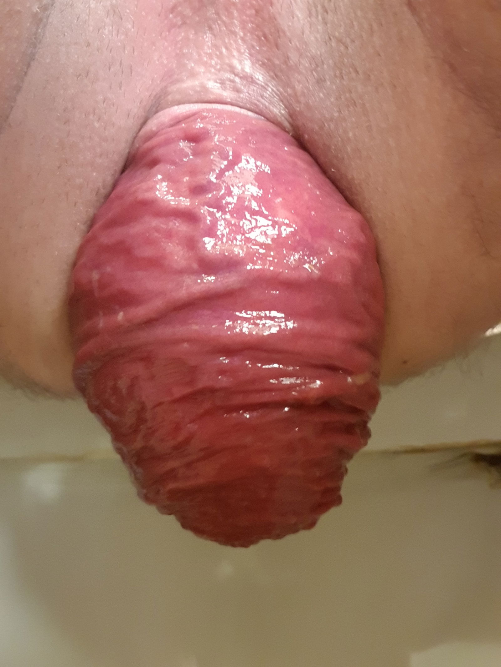 Photo by Buskowianka with the username @Buskowianka,  August 9, 2018 at 2:41 PM and the text says 'Another day of hard straining. Funny because of this part of bright pale tissue right at the top of the photo:D #prolapse  #anal  #young  #straight  #horny'