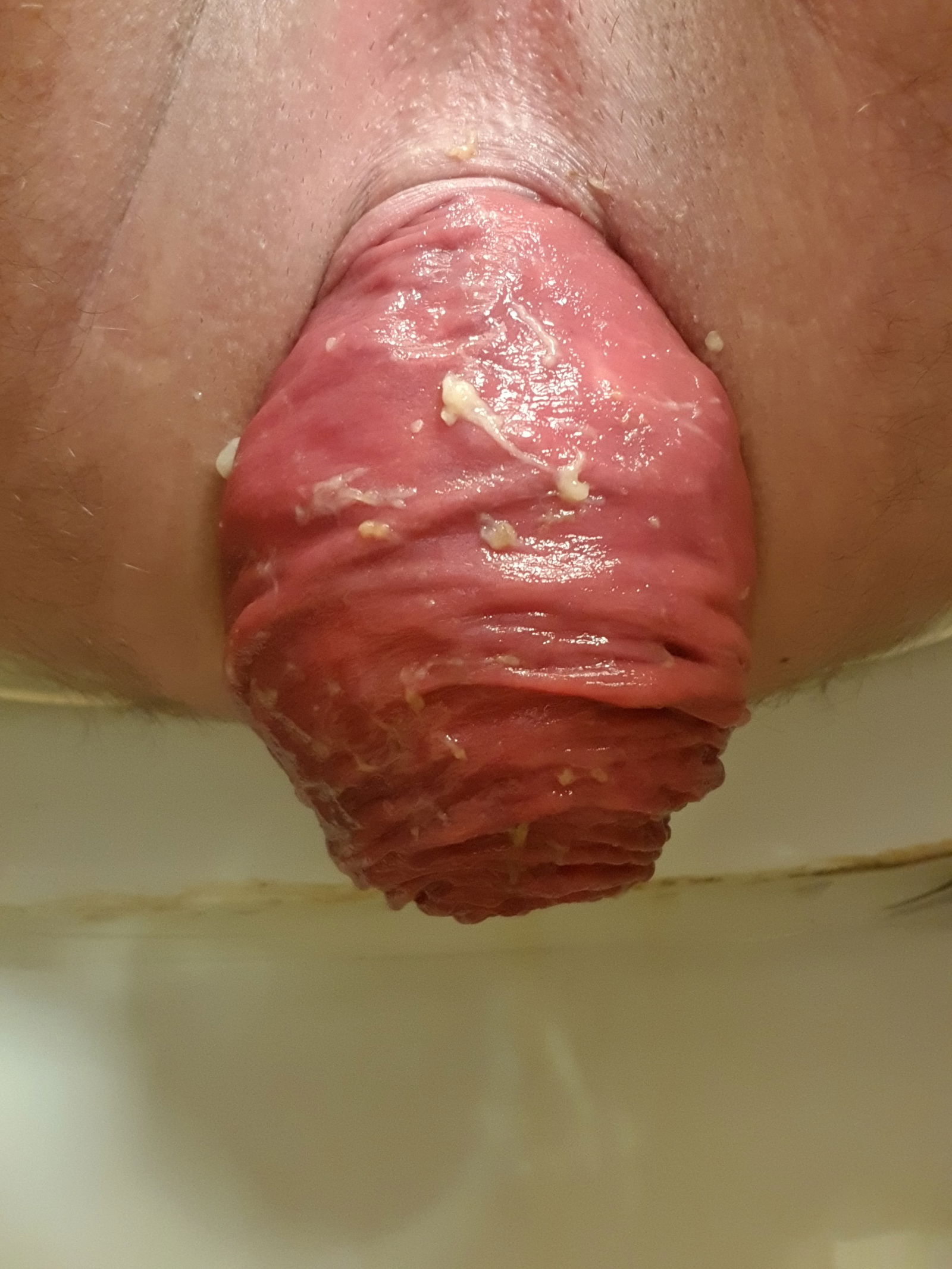 Photo by Buskowianka with the username @Buskowianka,  August 6, 2018 at 3:03 PM and the text says 'I haven&rsquo;t pushed it out quite a while ^^ #prolapse  #anal'