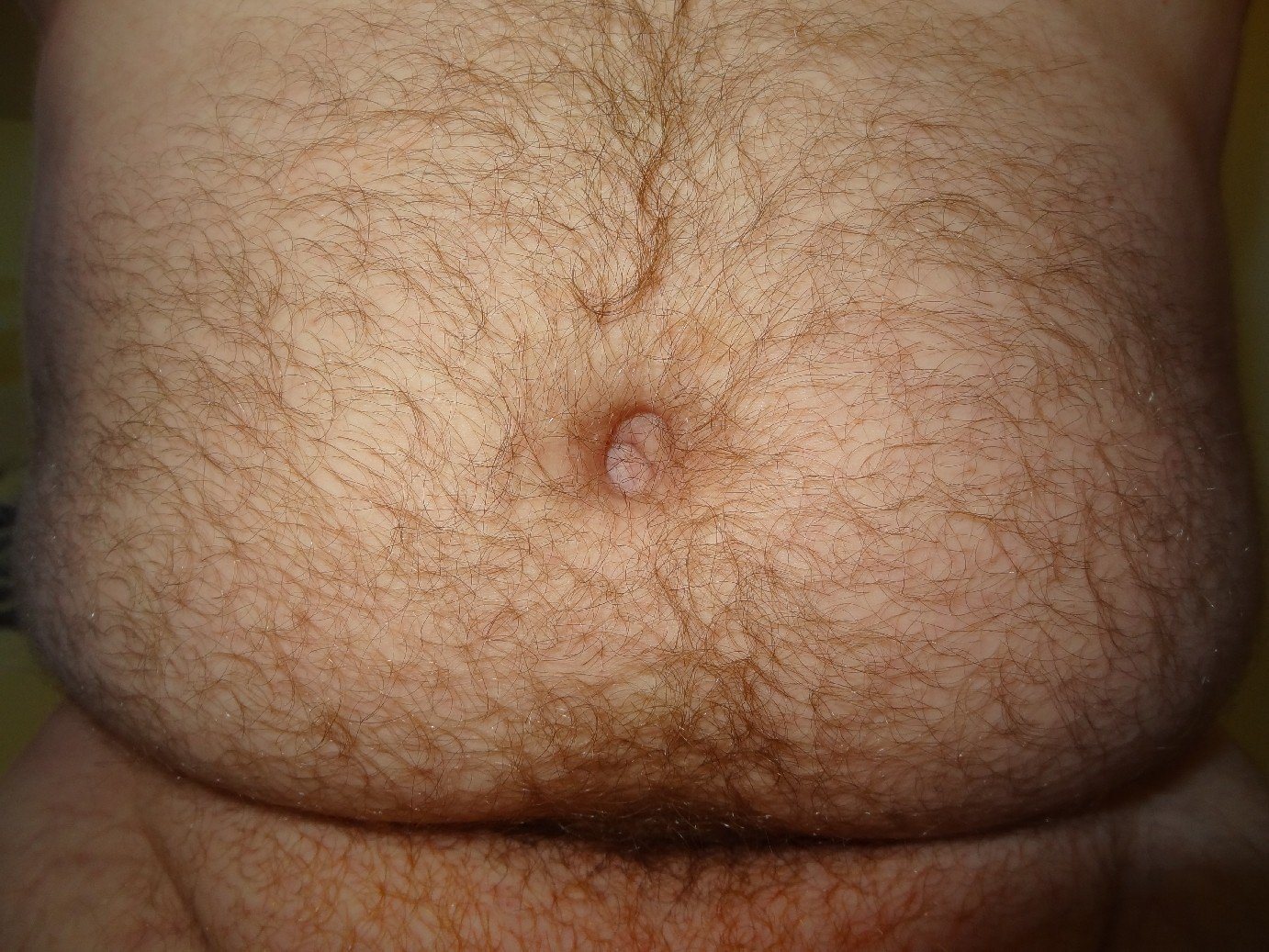 Photo by littlewithlittle with the username @littlewithlittle,  May 9, 2014 at 4:14 PM and the text says 'loveperfectimperfection:

My small penis and big belly… Hadn’t shaved for a while, what do you think? With, or without pubes?

Reblogged from my other blog loveperfectimperfection.tumblr.com. Personal posts will now be here. #small  #penis  #tiny  #penis ..'