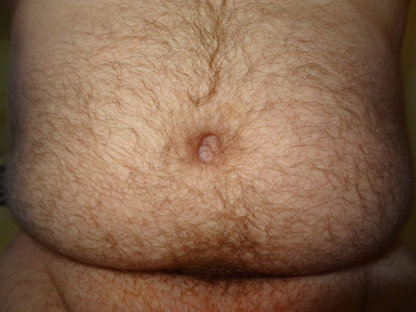 Photo by littlewithlittle with the username @littlewithlittle,  May 9, 2014 at 4:14 PM and the text says 'loveperfectimperfection:

My small penis and big belly… Hadn’t shaved for a while, what do you think? With, or without pubes?

Reblogged from my other blog loveperfectimperfection.tumblr.com. Personal posts will now be here. #small  #penis  #tiny  #penis ..'