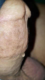 Album by Test28 with the username @Test28, who is a verified user,  October 24, 2024 at 1:04 PM. The post is about the topic Frenulum