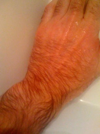 hairyhands