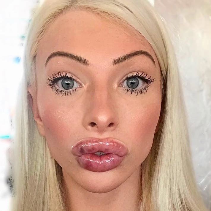Watch the Photo by AirheadBimboTrainer with the username @AirheadBimboTrainer, posted on October 30, 2019. The post is about the topic bimbofication. and the text says 'Fresh lip injects waiting for proper use'