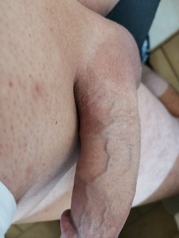 Photo by Tyrolean with the username @Tyrolean,  May 23, 2022 at 11:36 AM. The post is about the topic ILoveMycock and the text says 'Sooooo... Shaved 😍😁❤️'