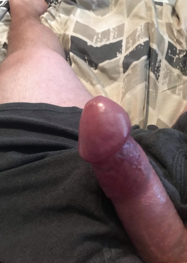 Photo by Shyguy50 with the username @Shyguy50,  December 2, 2023 at 2:32 PM. The post is about the topic Rate my pussy or dick and the text says 'waking up with a swollen head. fml'